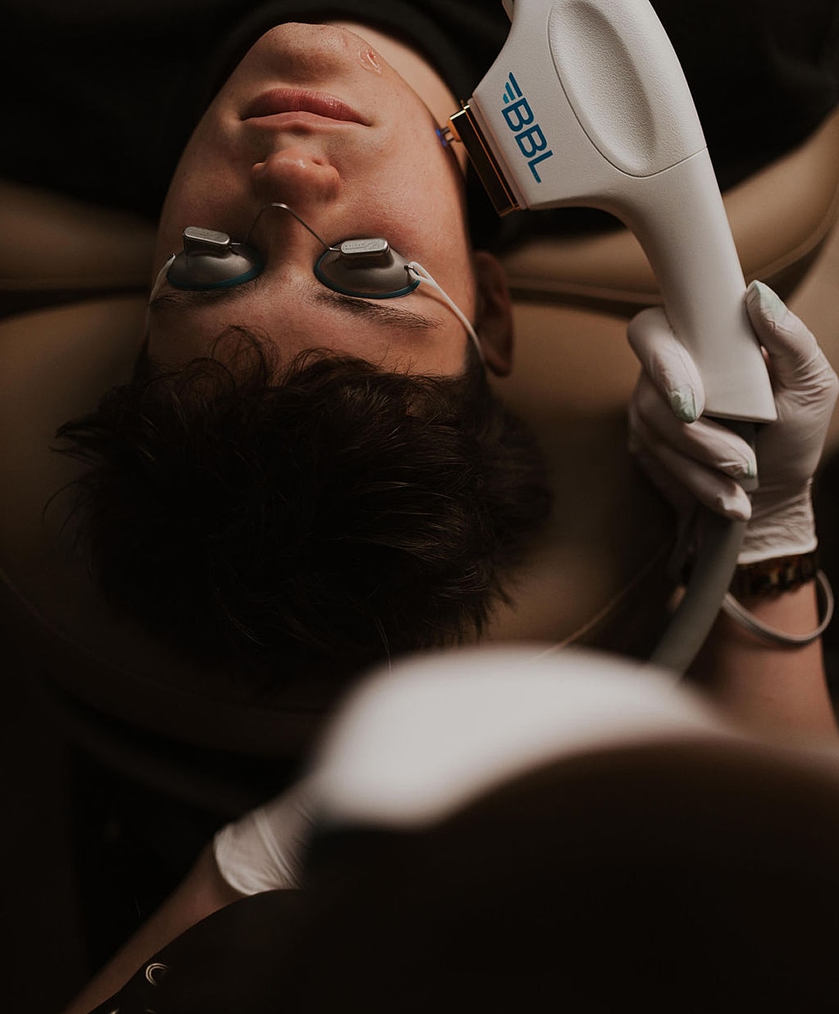BBL treatment session on a relaxed patient.
