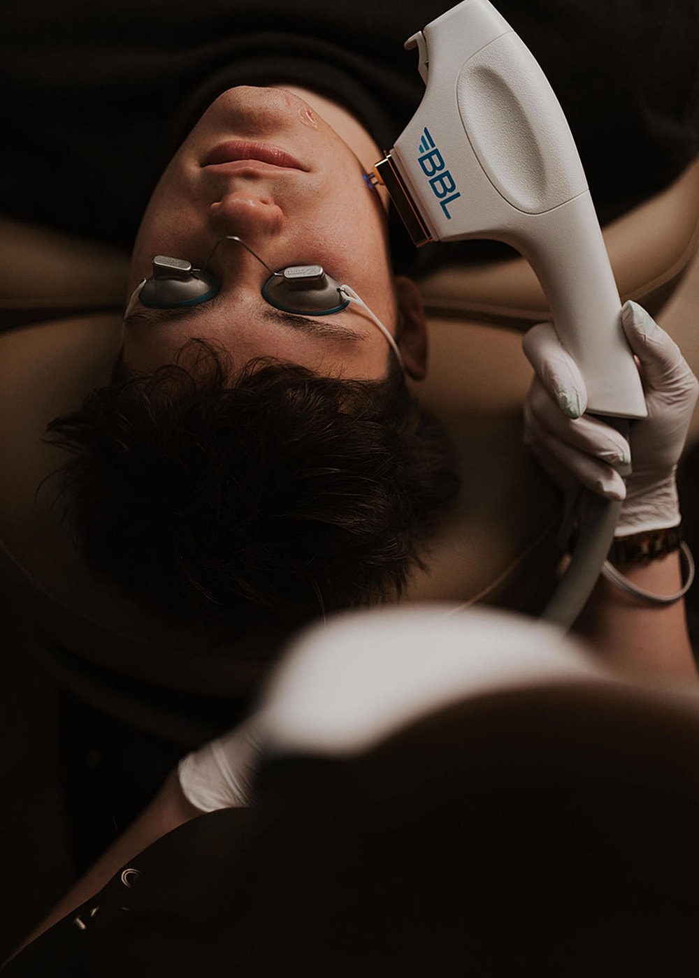Patient receiving skin treatment with laser device.