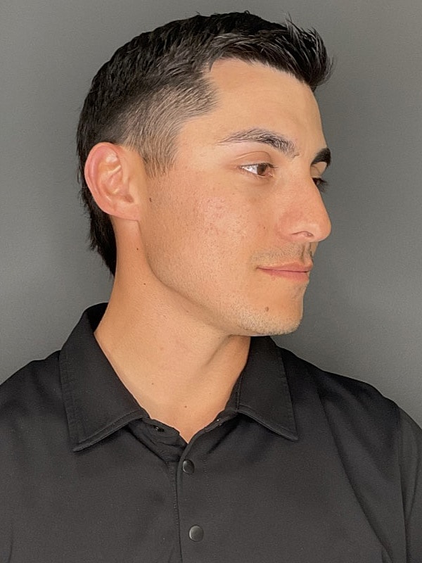 Laser Treatments Gallery Before & After