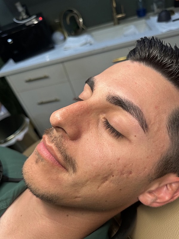 Laser Treatments Gallery Before & After
