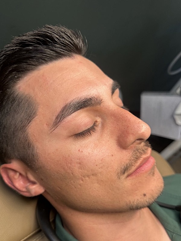 Laser Treatments Gallery Before & After