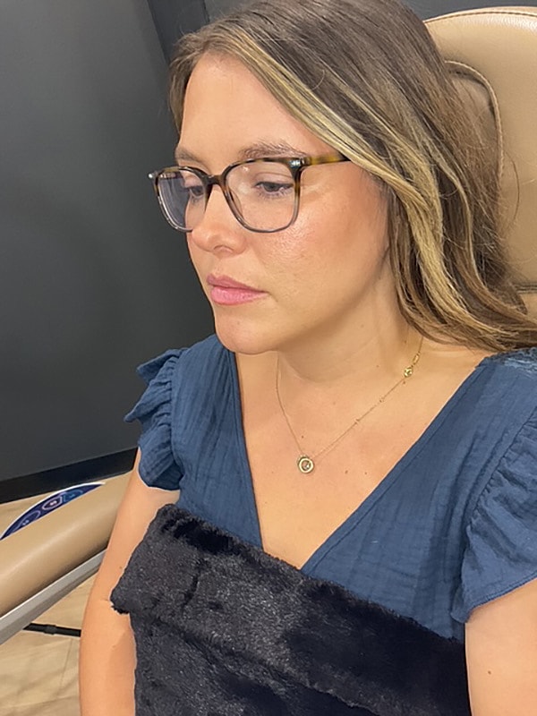 Lip Filler Gallery Before & After
