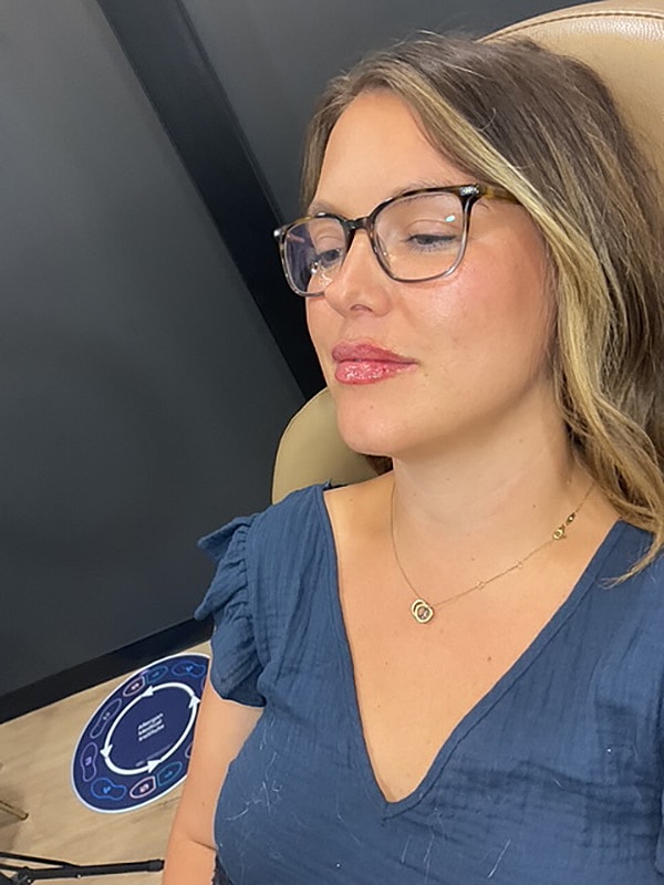 Lip Filler Gallery Before & After