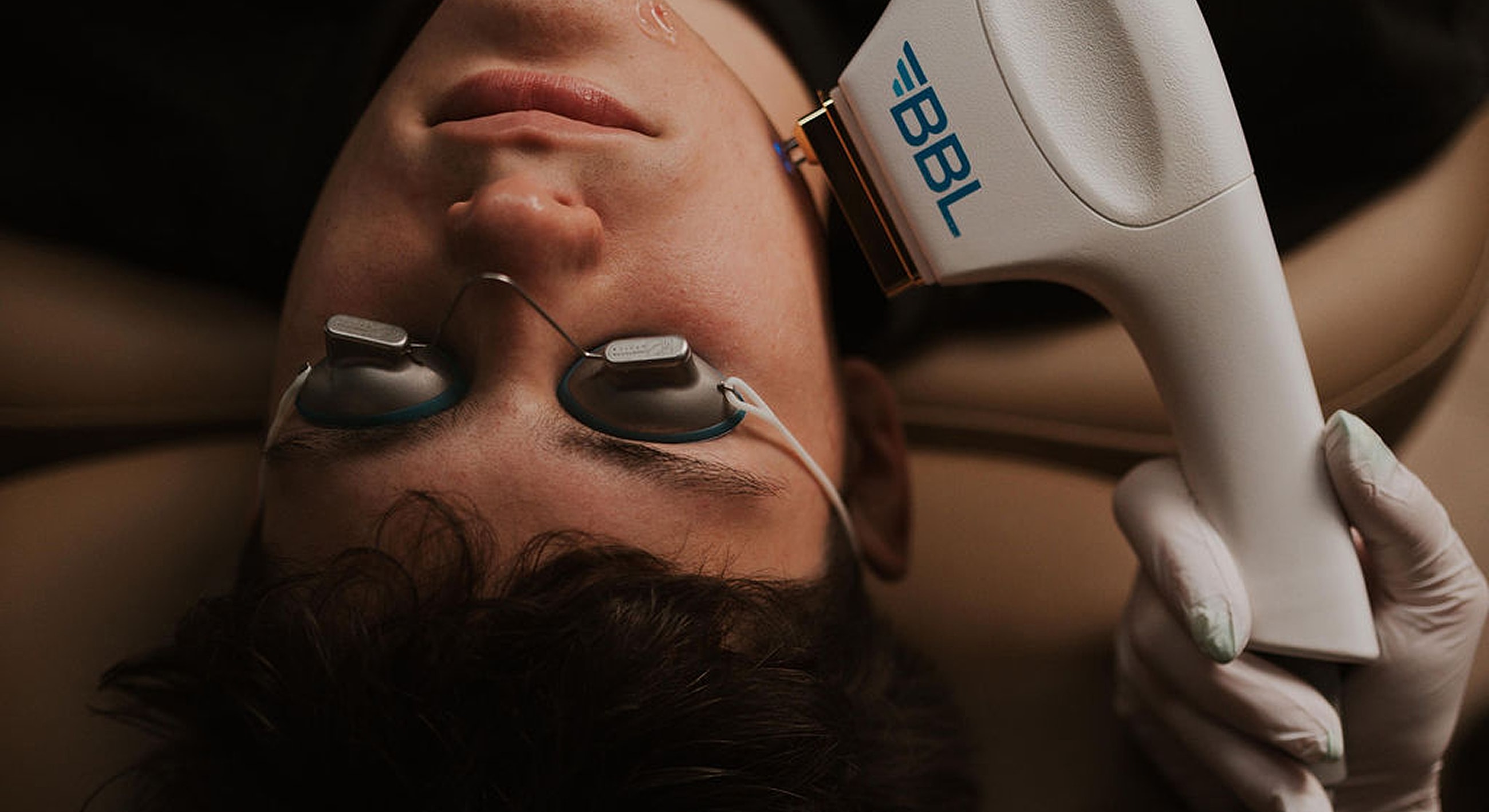 BBL treatment session on a patient with goggles.